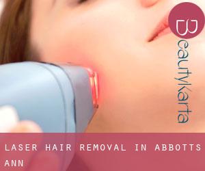Laser Hair removal in Abbotts Ann