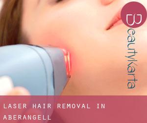 Laser Hair removal in Aberangell