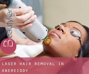 Laser Hair removal in Abereiddy
