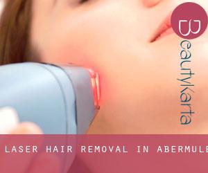 Laser Hair removal in Abermule