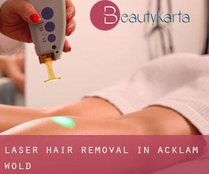 Laser Hair removal in Acklam Wold