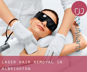 Laser Hair removal in Albrighton