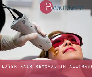 Laser Hair removal in Alltmawr