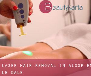 Laser Hair removal in Alsop en le Dale