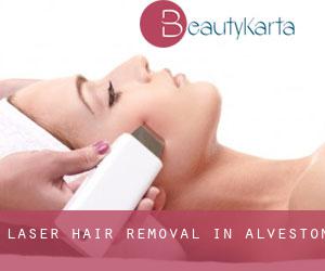 Laser Hair removal in Alveston