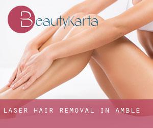 Laser Hair removal in Amble