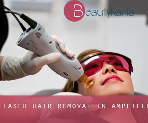 Laser Hair removal in Ampfield