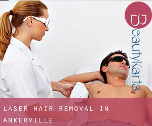 Laser Hair removal in Ankerville