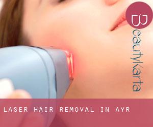Laser Hair removal in Ayr