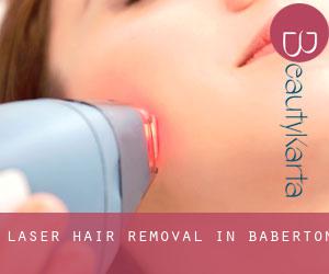 Laser Hair removal in Baberton