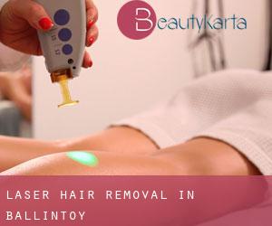 Laser Hair removal in Ballintoy