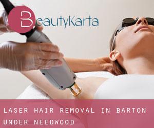 Laser Hair removal in Barton under Needwood