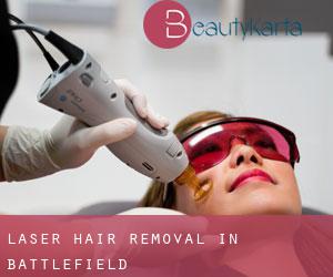 Laser Hair removal in Battlefield