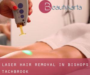 Laser Hair removal in Bishops Tachbrook