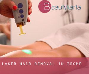 Laser Hair removal in Brome