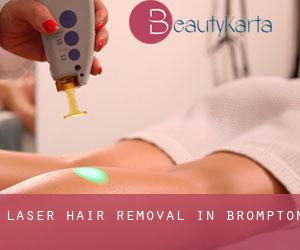 Laser Hair removal in Brompton