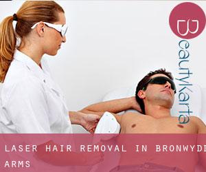 Laser Hair removal in Bronwydd Arms