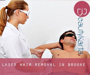 Laser Hair removal in Brooke