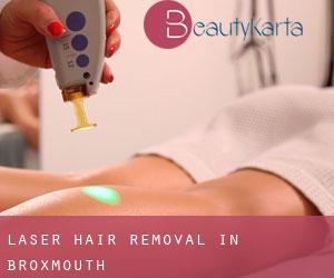 Laser Hair removal in Broxmouth