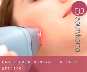 Laser Hair removal in Cae'r-geiliog Laser Hair removal in Cae'r-geiliog