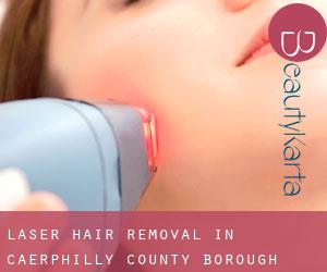 Laser Hair removal in Caerphilly (County Borough)