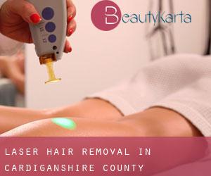 Laser Hair removal in Cardiganshire County