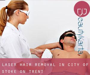 Laser Hair removal in City of Stoke-on-Trent