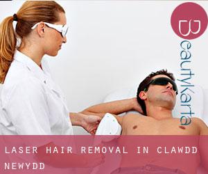 Laser Hair removal in Clawdd-newydd