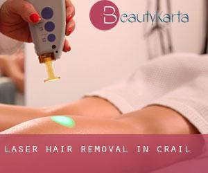 Laser Hair removal in Crail