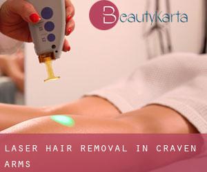 Laser Hair removal in Craven Arms