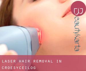 Laser Hair removal in Croesyceilog
