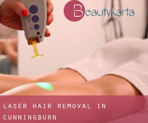 Laser Hair removal in Cunningburn