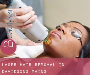 Laser Hair removal in Davidsons Mains