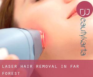 Laser Hair removal in Far Forest
