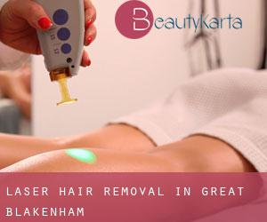 Laser Hair removal in Great Blakenham