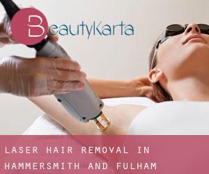 Laser Hair removal in Hammersmith and Fulham