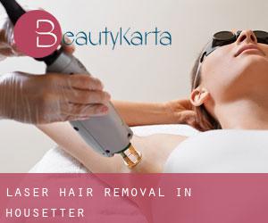 Laser Hair removal in Housetter