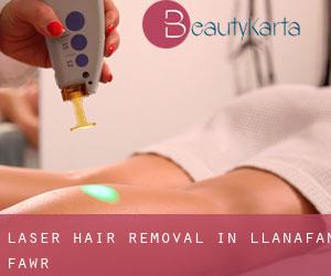 Laser Hair removal in Llanafan-fawr
