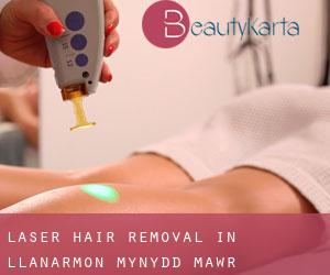 Laser Hair removal in Llanarmon-Mynydd-mawr