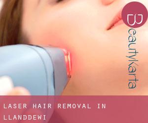 Laser Hair removal in Llanddewi