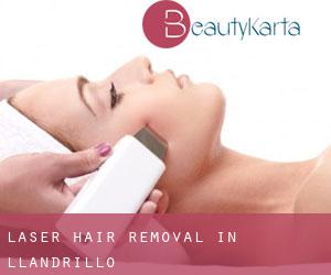 Laser Hair removal in Llandrillo