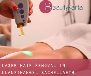 Laser Hair removal in Llanfihangel Bachellaeth