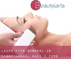 Laser Hair removal in Llanfihangel-Rhos-y-corn
