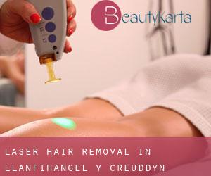 Laser Hair removal in Llanfihangel-y-creuddyn
