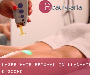 Laser Hair removal in Llanvair Discoed
