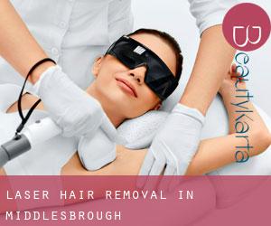 Laser Hair removal in Middlesbrough