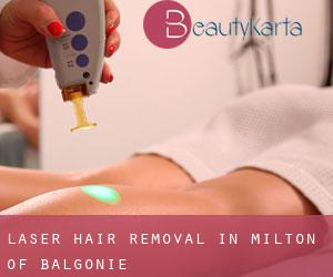 Laser Hair removal in Milton of Balgonie