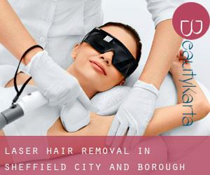 Laser Hair removal in Sheffield (City and Borough)