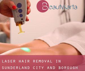 Laser Hair removal in Sunderland (City and Borough)