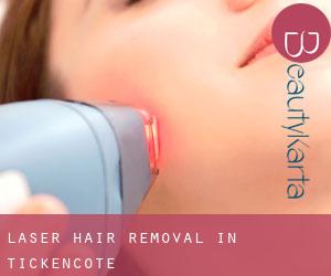 Laser Hair removal in Tickencote